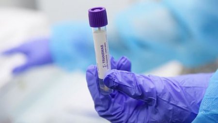 Azərbaycanda daha bir nəfər koronavirusdan öldü: 163 yeni yoluxma - FOTO