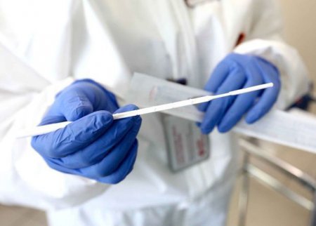 Deputat: “Koronavirus testinin qiymətinə yenidən baxılmalıdır”