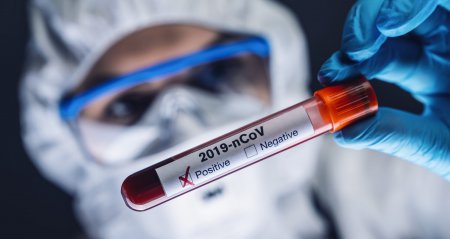 Azərbaycanda daha 105 nəfərdə koronavirus aşkarlanıb