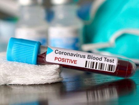 Azərbaycanda daha 257 nəfərdə koronavirus aşkarlandı - 3 nəfər vəfat etdi, 202 pasiyent sağaldı