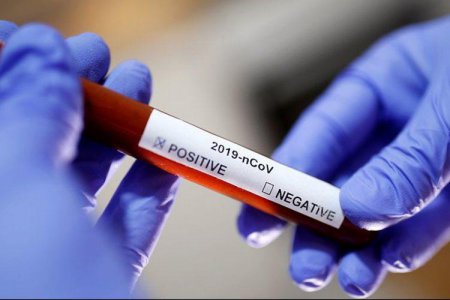 Azərbaycanda 168 yeni koronavirus infeksiyasına yoluxma faktı qeydə alınmış, 80 nəfər müalicə olunaraq sağalmış və evə buraxılıb.