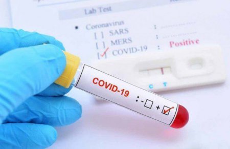 Koronavirusu simptomsuz keçirməyi necə müəyyənləşdirmək olar? - AÇIQLAMA