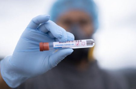Azərbaycanda daha 542 nəfərdə koronavirus aşkarlandı - 9 pasiyent öldü