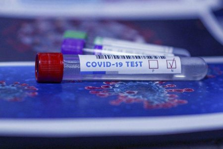 Daha 471 yeni koronavirusa yoluxdu - 7 ölü