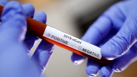 Azərbaycanda bir sutkada 347 nəfər koronavirusa yoluxdu - 6 ölü