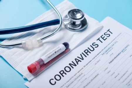 Koronavirus testindən imtina edən işçilər cərimə olunacaqlar